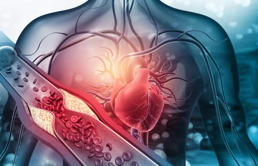 unveiling the overlooked silent vascular killer and how vitamin k2 builds a protective barrier for the heart unveiling the overlooked silent vascular killer and how vitamin k2 builds a protective barrier for the heart